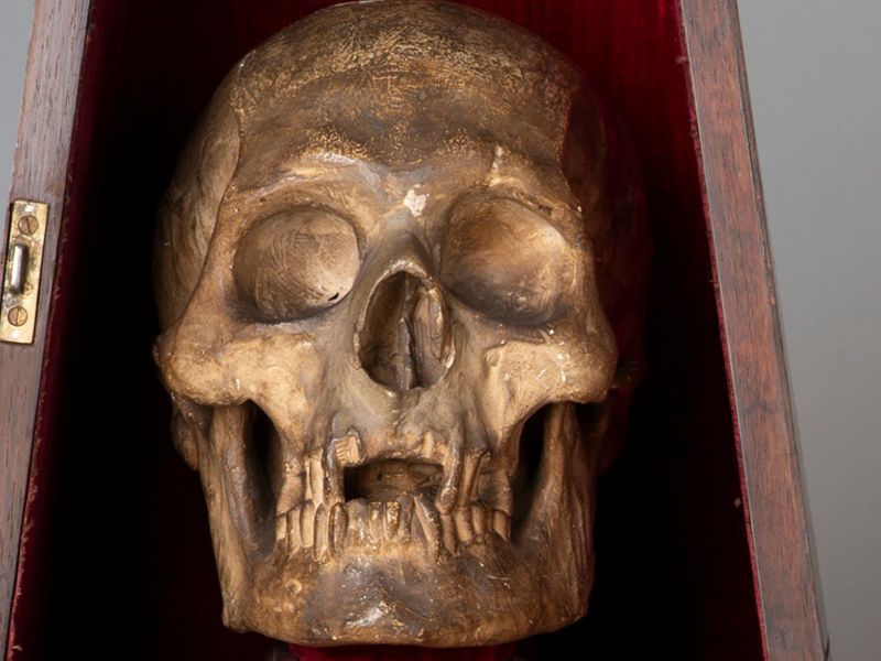 Up close: Robert the Bruce’s skull cast