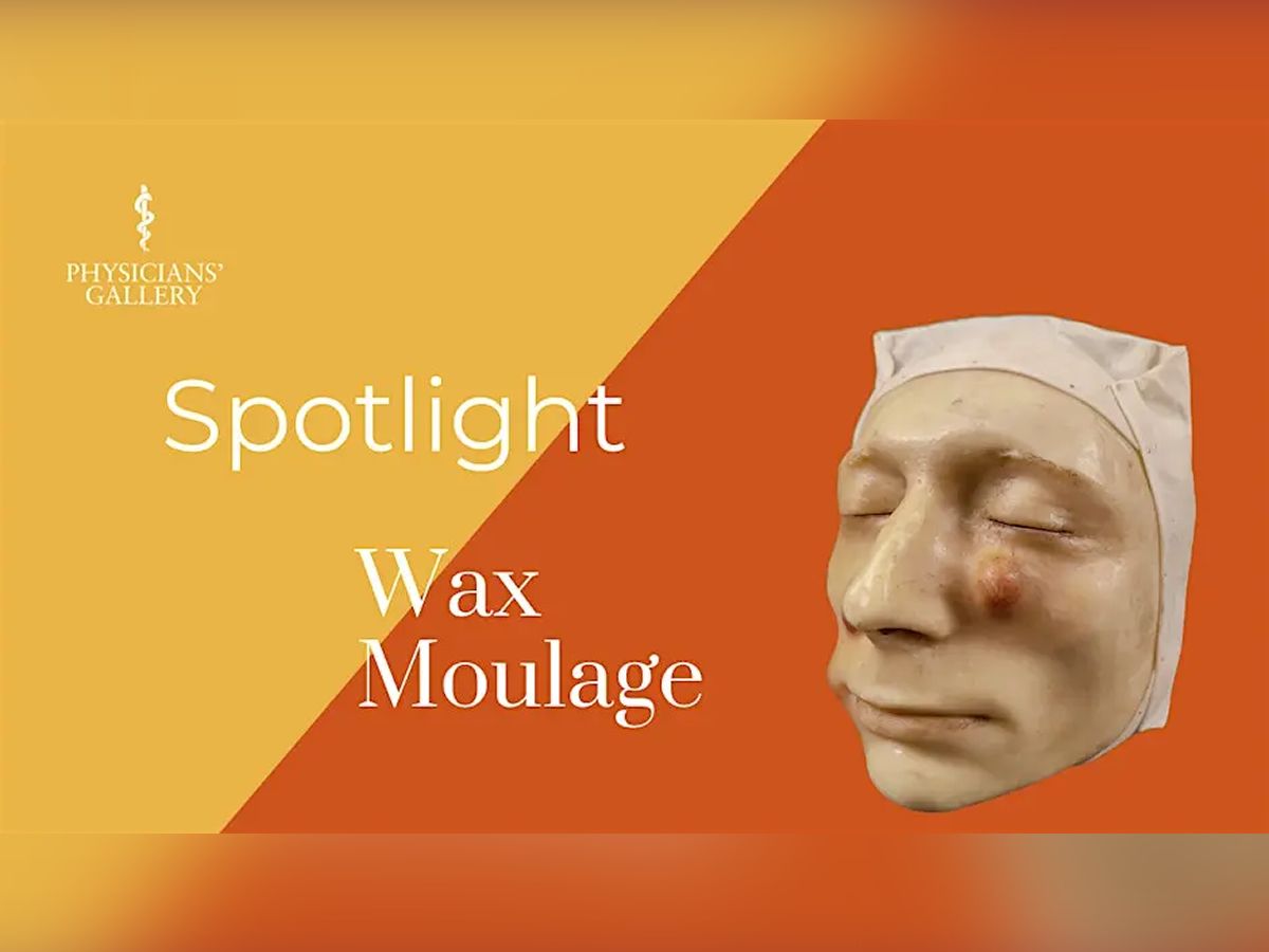 Spotlight Talk: Wax Moulage